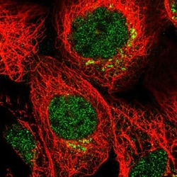 MDFIC Antibody, Novus Biologicals 0.1mL; Unlabeled:Antibodies, Polyclonal